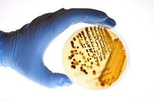 A blue-gloved hand holding a petri dish with bacteria.